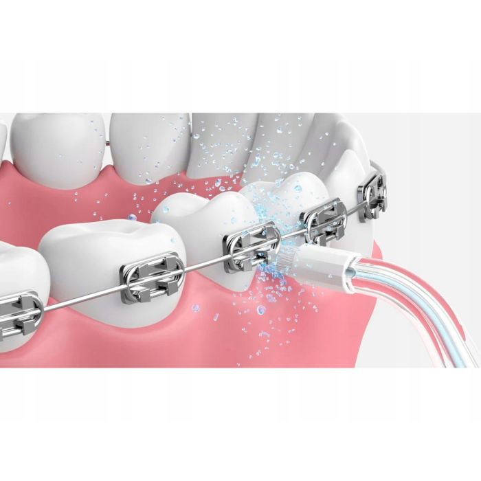 Насадка для ирригатора Oclean Nozzle for A10-Orthodontics 2 шт (6970810556131) изображение 4