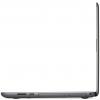 Ноутбук Dell Inspiron 5565 (I55HA645DDL-FG) изображение 6