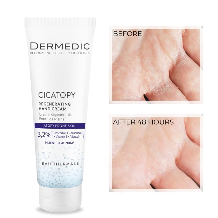 Крем для рук Dermedic Cicatopy Восстанавливающий 75 мл (5901643176471) изображение 2