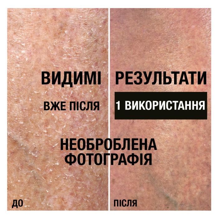Лосьйон для тіла Neutrogena Інтенсивне відновлення 250 мл (3574660533286/3574661751603) зображення 6