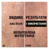 Лосьйон для тіла Neutrogena Інтенсивне відновлення 250 мл (3574660533286/3574661751603) зображення 6
