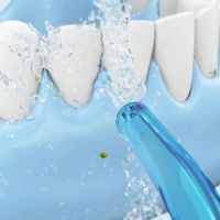 Ирригатор Soocas W3PRO Portable Oral Irrigator изображение 5