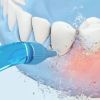 Ирригатор Soocas W3PRO Portable Oral Irrigator изображение 6