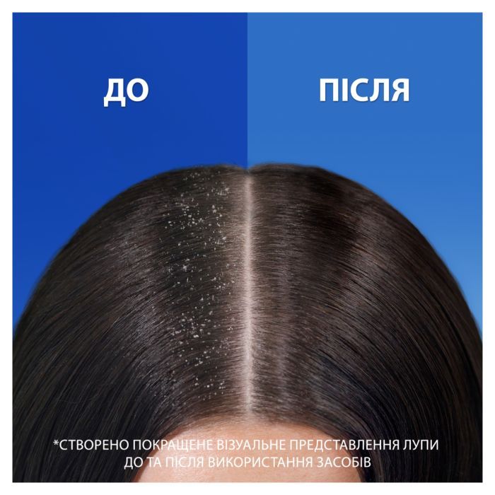 Шампунь Head & Shoulders 2 в 1 Против перхоти Свежесть ментола 330 мл (8700216304825) изображение 6