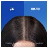 Шампунь Head & Shoulders 2 в 1 Против перхоти Свежесть ментола 330 мл (8700216304825) изображение 6