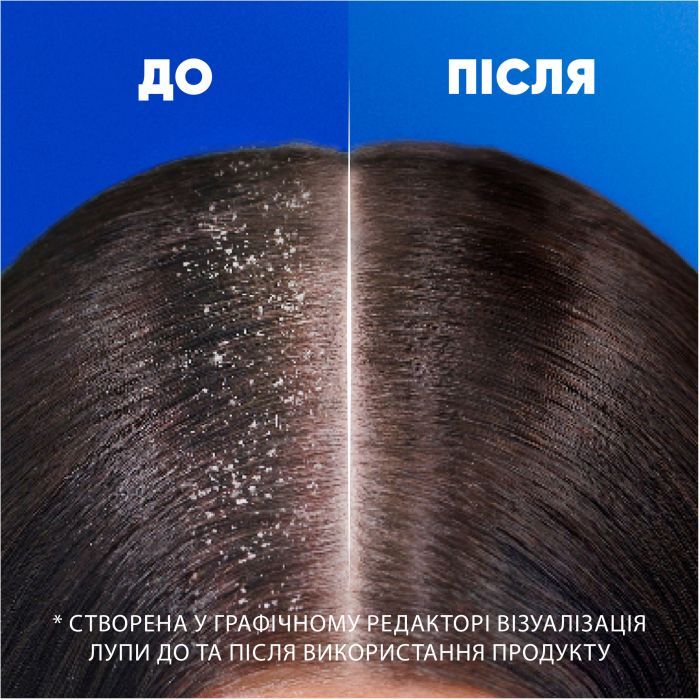 Шампунь Head & Shoulders 2 в 1 Проти лупи Основний догляд 330 мл (8700216157919) зображення 6