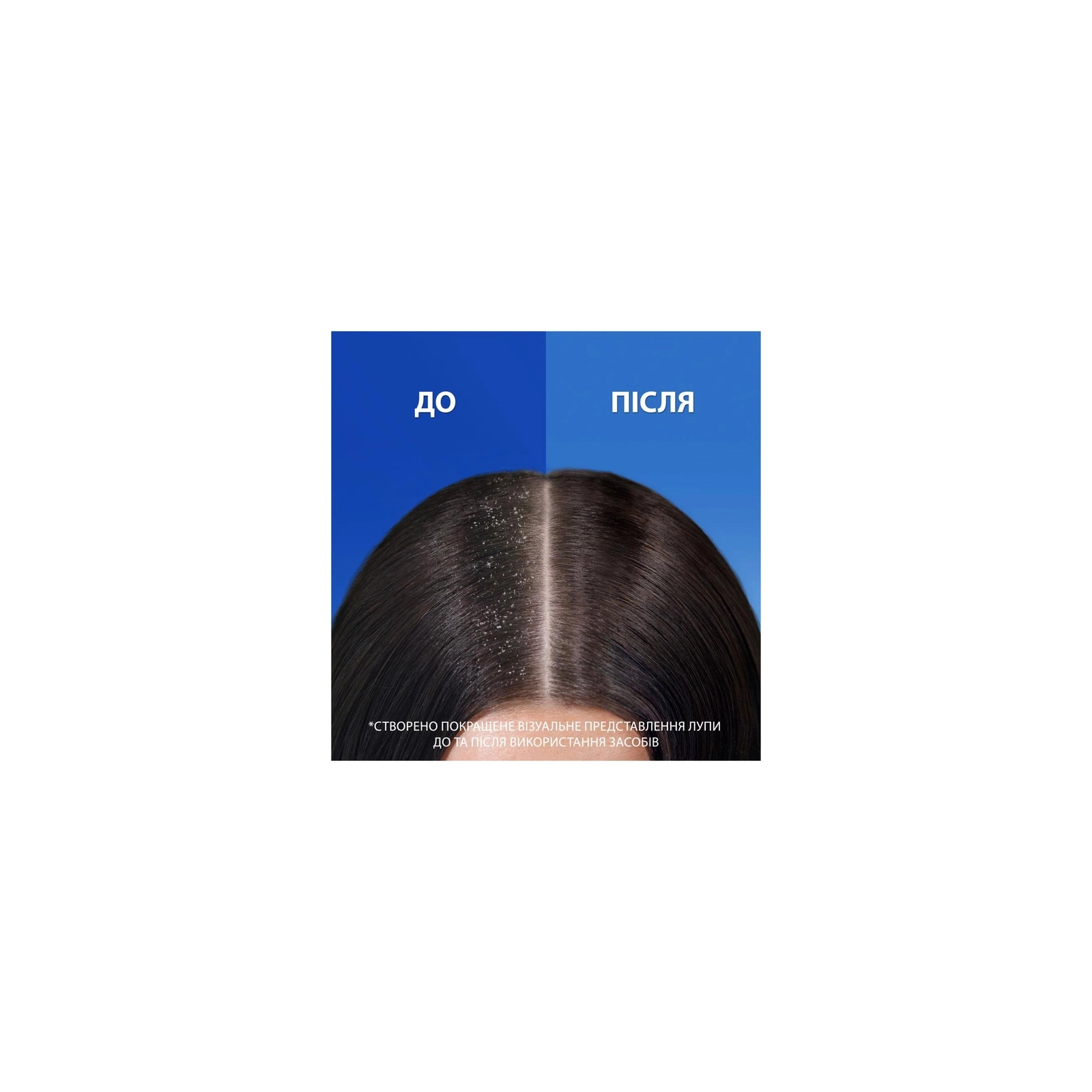 Шампунь Head & Shoulders Проти лупи Яблучна свіжість 800 мл (8700216306782) зображення 3
