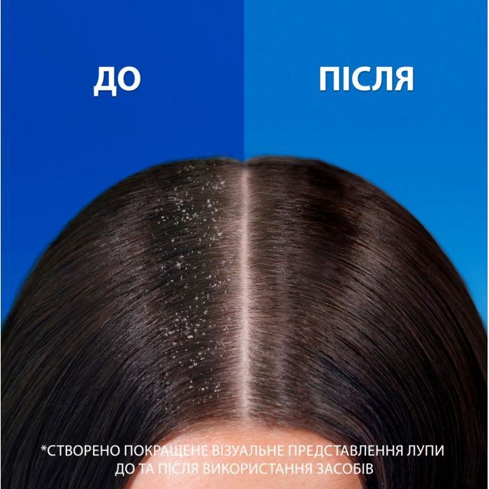 Шампунь Head & Shoulders Pro-Expert 7 Интенсивное спасение 250 мл (8700216156844) изображение 3