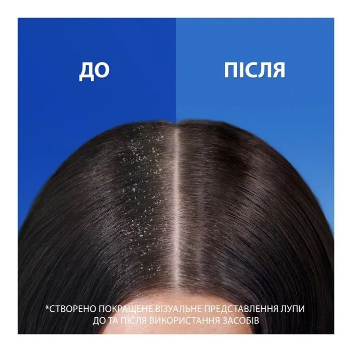 Шампунь Head & Shoulders Цитрусова свіжість 400 мл (5011321336032) зображення 3