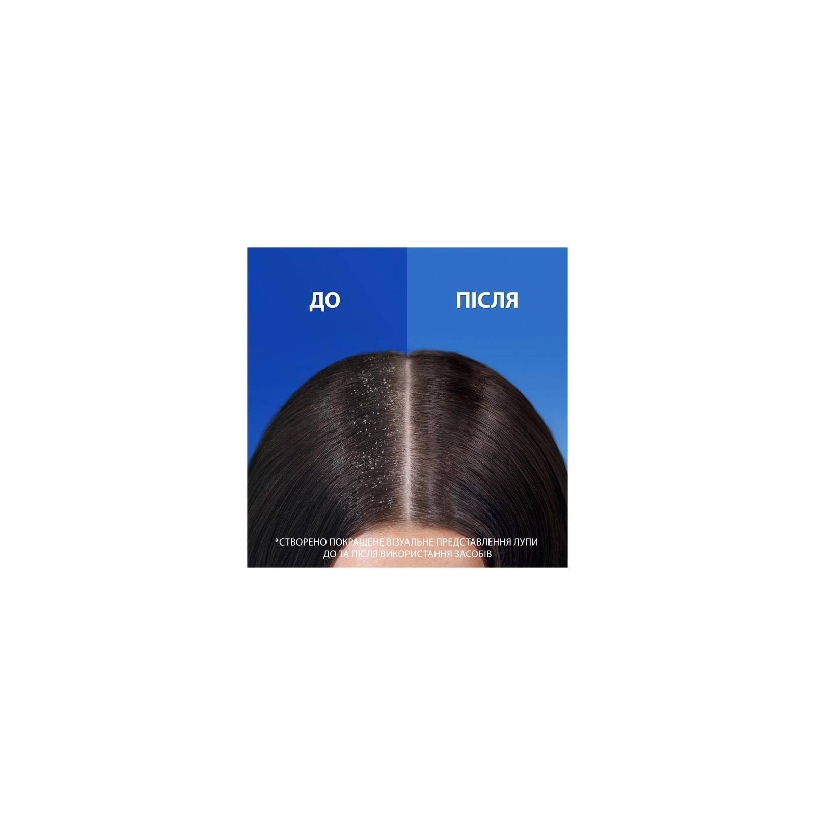 Шампунь Head & Shoulders Цитрусовая свежесть 400 мл (5011321336032) изображение 3