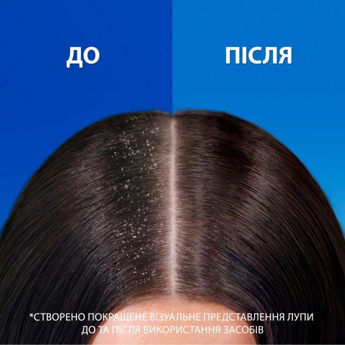 Шампунь Head & Shoulders Pro-Expert 7 Защита от выпадения волос С кофеином 250 мл (8700216156936) изображение 6