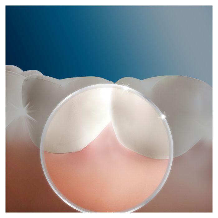 Ирригатор Oral-B Prof Care (MD20) изображение 7