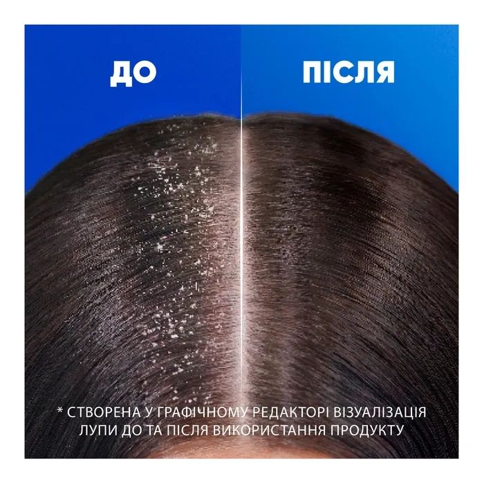 Шампунь Head & Shoulders 2 в 1 Против перхоти Основной уход 400 мл (8700216304917) изображение 4