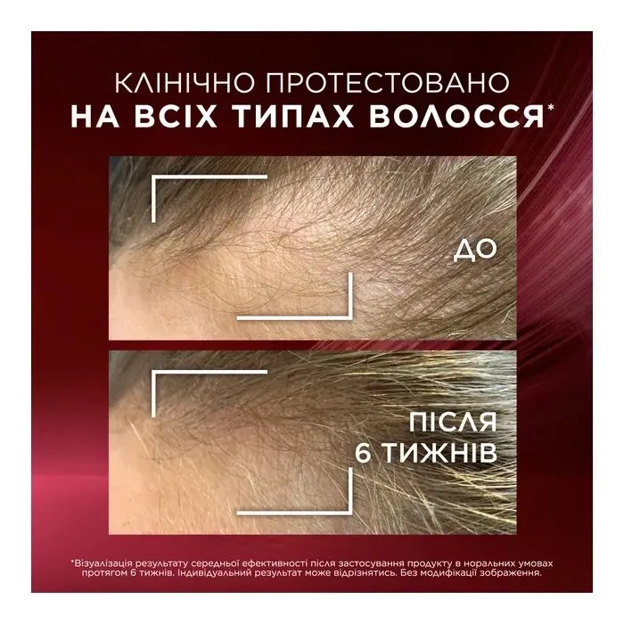 Сироватка для волосся Elseve Full Resist Arginine + Aminexil 102 мл (3600524075408) зображення 6