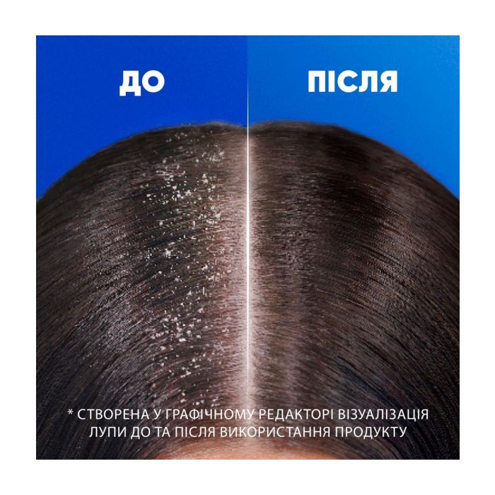 Шампунь Head & Shoulders 2 в 1 Против перхоти Основной уход 400 мл (8700216304917) изображение 6