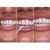 Средство для отбеливания зубов SmileKit Glostik Блеск для зубов 4 мл (5.3020) изображение 5
