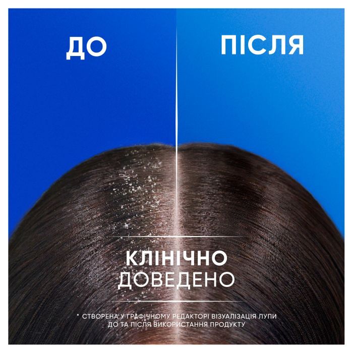 Шампунь Head & Shoulders 2 в 1 Против перхоти Свежесть ментола 400 мл (8700216305419) изображение 4