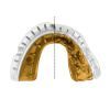 Капа Opro Gold Braces під брекети White/Gold (102506004) (Gold_Braces_Wh/Gold) изображение 9