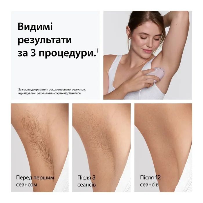 Фотоэпилятор Braun PL1111 + GIL Venus изображение 3