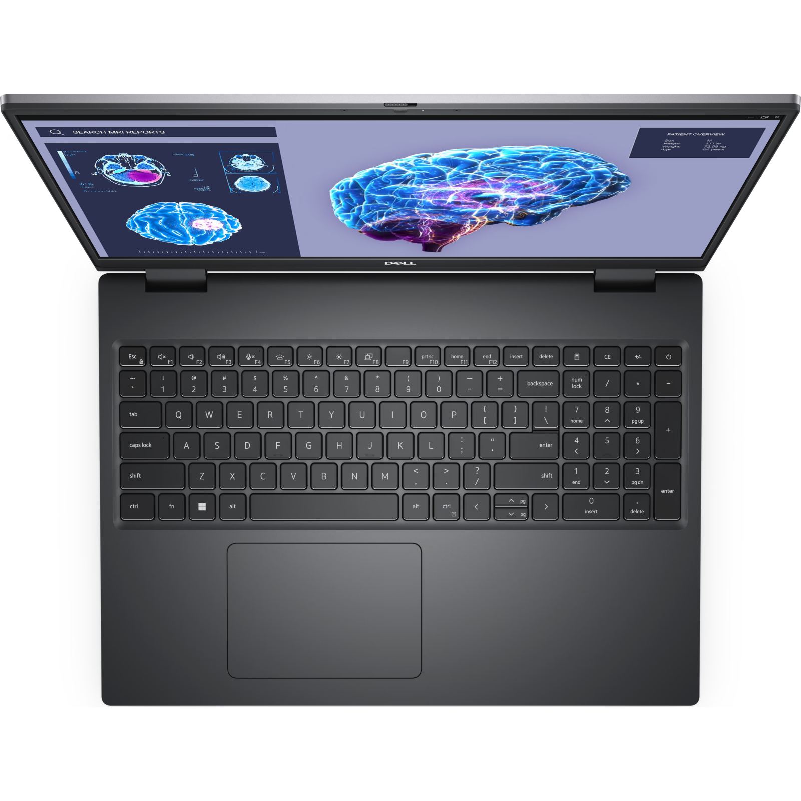 Ноутбук Dell Precision 7680 (210-BGNT_i9321TBW11P) зображення 4