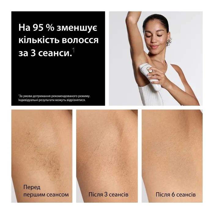 Фотоэпилятор Braun PL5351 + GIL Venus изображение 3