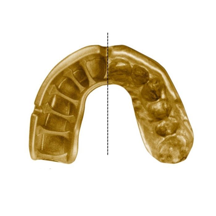 Капа Opro Gold Black/Gold (102504001) (Gold_Bl/Gold) изображение 3
