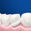 Электрическая зубная щетка Oral-B Vitality D103.413.3 Protect x clean (4210201427124) изображение 7