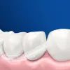 Електрична зубна щітка Oral-B Vitality D103.413.3 Protect x clean (4210201427124) зображення 7