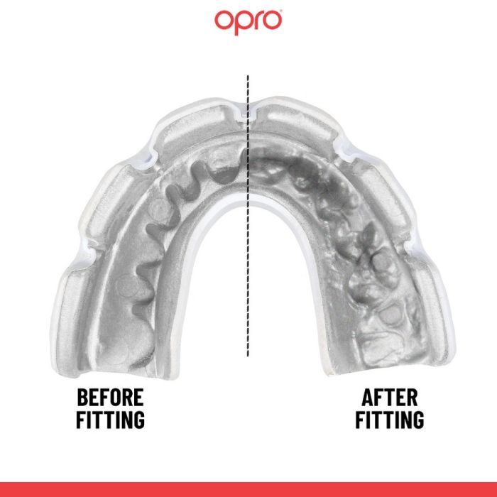 Капа Opro Instant Single Colour Braces Clear (102522007) (Instant_Braces_Clear) изображение 4
