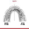 Капа Opro Instant Single Colour Braces Clear (102522007) (Instant_Braces_Clear) изображение 4