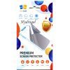 Плівка захисна Drobak Hydrogel Xiaomi Mi Smart Band 7 (2 шт) (313184) (313184) зображення 4