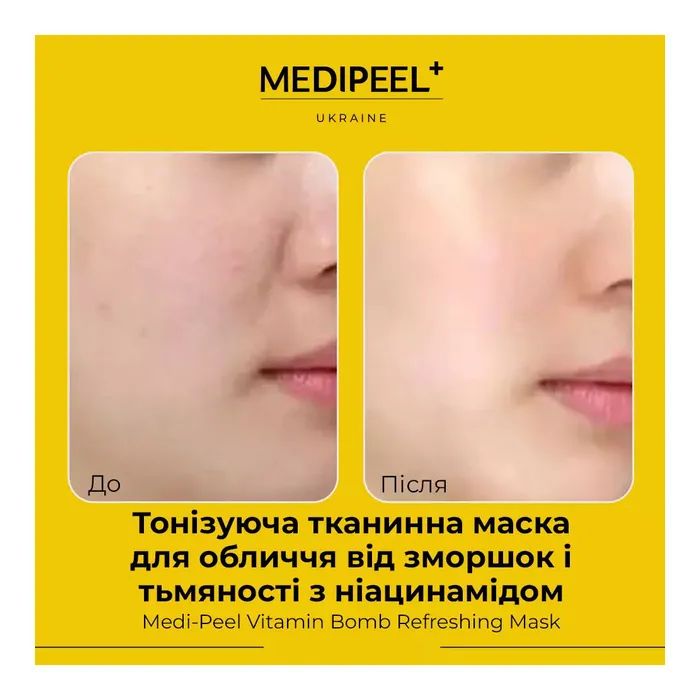 Маска для лица Medi-Peel Vitamin Bomb Refreshing Mask Тканевая 1 шт 25 мл (8809409345390) изображение 3