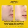 Маска для лица Medi-Peel Vitamin Bomb Refreshing Mask Тканевая 1 шт 25 мл (8809409345390) изображение 3