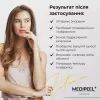 Маска для лица Medi-Peel Vitamin Bomb Refreshing Mask Тканевая 1 шт 25 мл (8809409345390) изображение 5