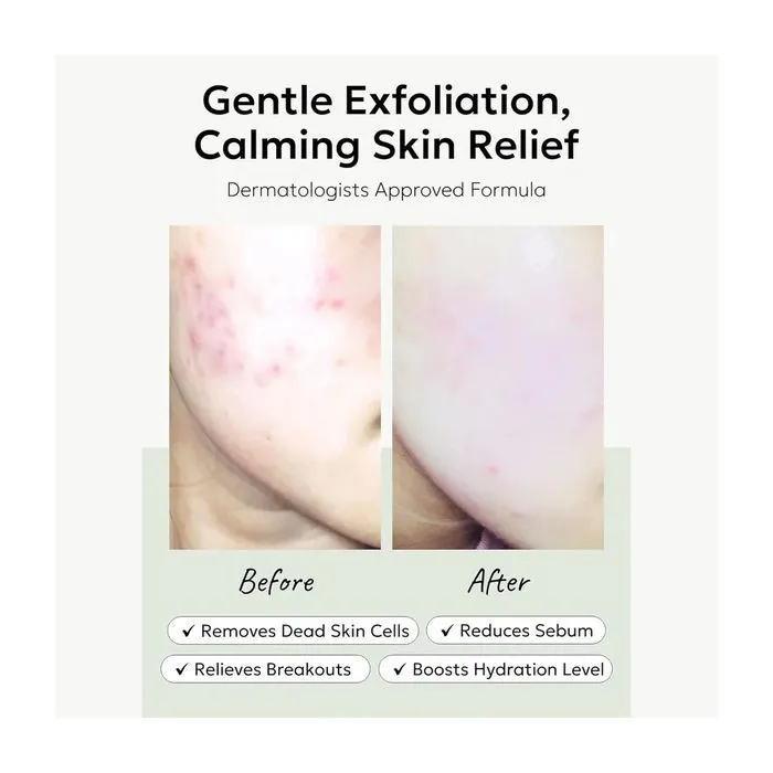 Пилинг для лица Celimax Hearleaf BHA Peeling Pad 60 шт (8809463992615) изображение 2