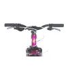 Велосипед Formula 20" BLACKWOOD Vbr FR рама-11" AL 2026 малиновий (OPS-FR-20-106) зображення 6