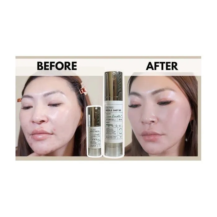 Сыворотка для лица VT Cosmetics Cica Reedle Shot 300 50 мл (8809695678431) изображение 3