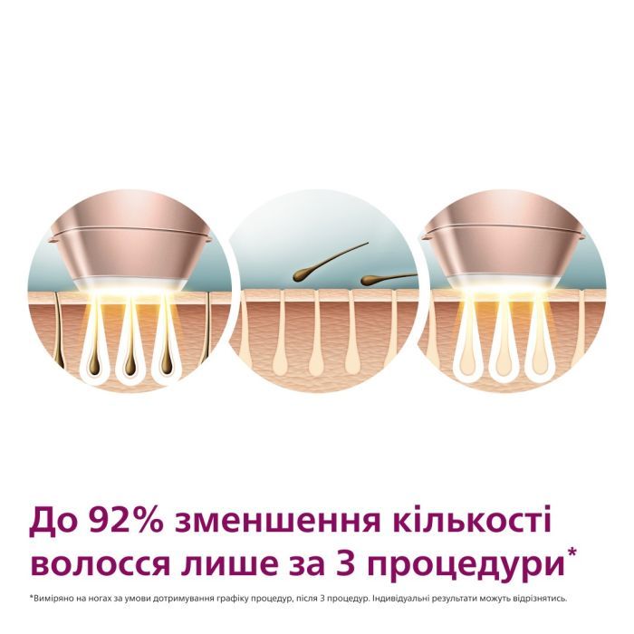 Фотоэпилятор Philips BRI977/00 изображение 4