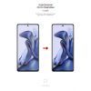 Плівка захисна Armorstandart Matte Xiaomi 11T (ARM61176) зображення 3