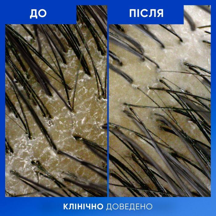 Шампунь Head & Shoulders Clarify & Shine Против перхоти Очищение и блеск 400 мл (8700216658461) изображение 7