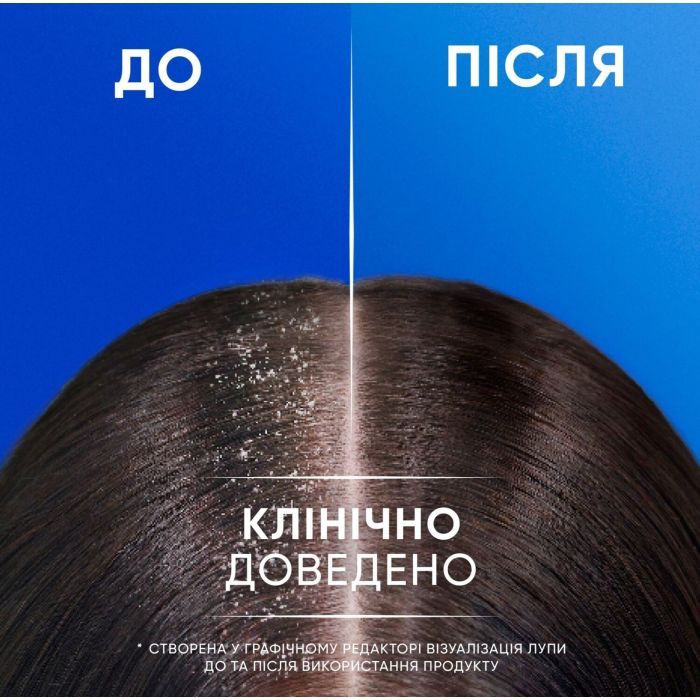 Шампунь Head & Shoulders 2 в 1 Против перхоти Яблочная свежесть 330 мл (8700216304689) изображение 6