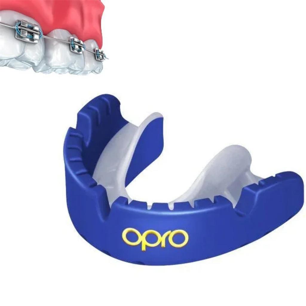 Капа Opro Self-fit GEN4 Gold Braces Red/Pearl (art_002227008)
