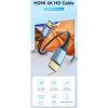 Кабель мультимедийный HDMI to HDMI 10.0m V2.0 4K 60Hz Aluminum Alloy Blue Vention (ALHSL) изображение 7