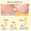 Маска для обличчя Medicube Kojic Acid Turmeric Brightening y Gel Mask Освітлювальна 28 г (8800256114658) зображення 6