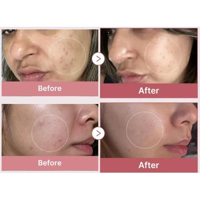 Сыворотка для лица Medicube PDRN Pink Peptide Serum 30 мл (8800256108053) изображение 6
