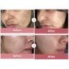 Сыворотка для лица Medicube PDRN Pink Peptide Serum 30 мл (8800256108053) изображение 6