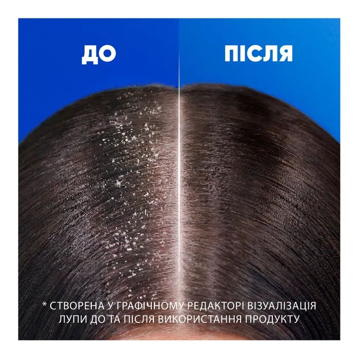 Шампунь Head & Shoulders Цитрусова свіжість 400 мл (5011321336032) зображення 4