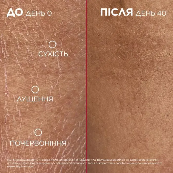Крем для тіла Mixa Urea Cica Repair+ Regenerating Cream 400 мл (3600551135922) зображення 5